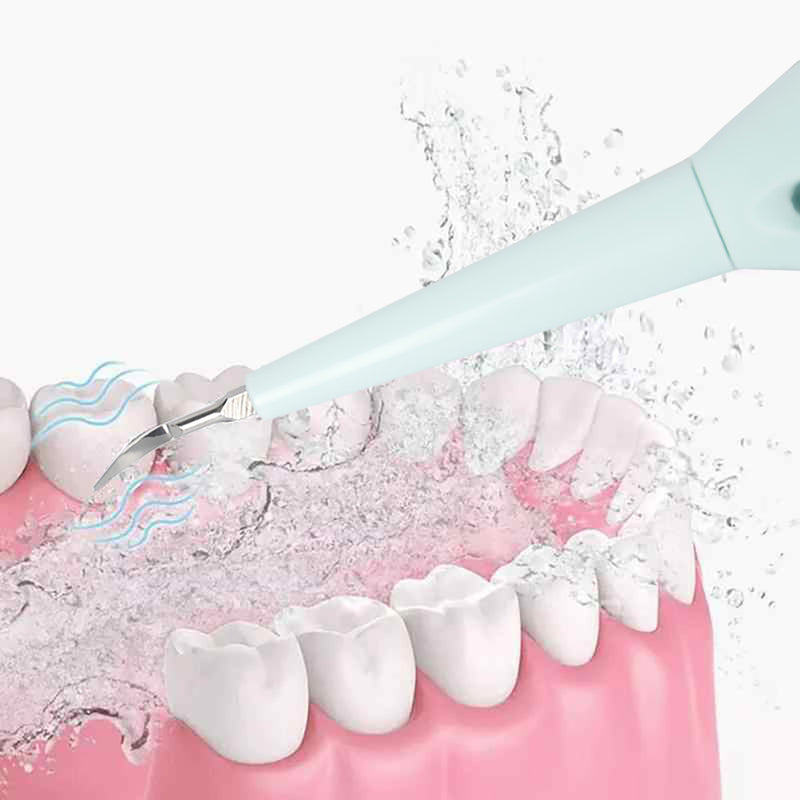 Limpiador sónico de cálculos dentales